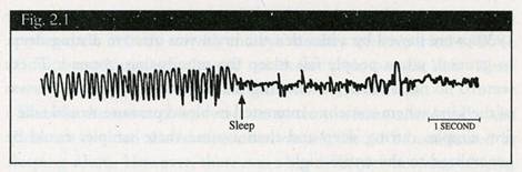sleep brainwave showing we fall asleep rapidly