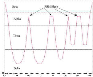 Sleep stages graph showing REM sleep spikes