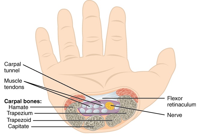 Carpal Tunnel Syndrome